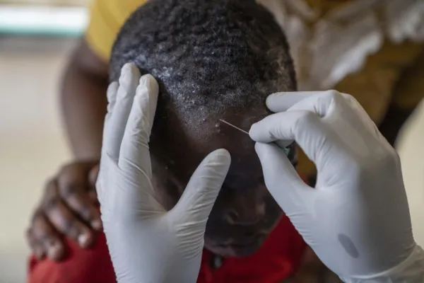 Mpox Kenya
