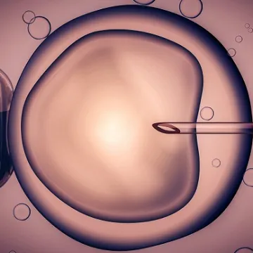 ivf-2