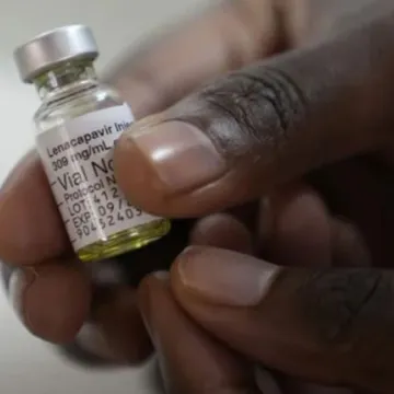 HIV