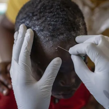 Mpox Kenya