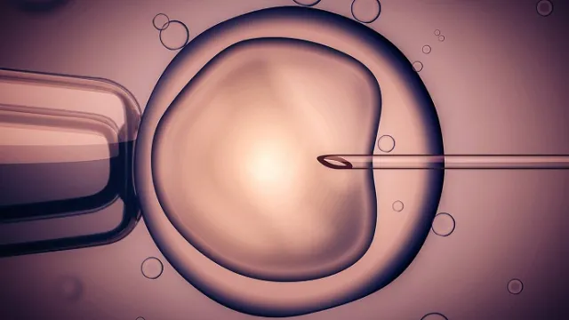 ivf-2