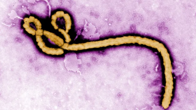 Ebola 